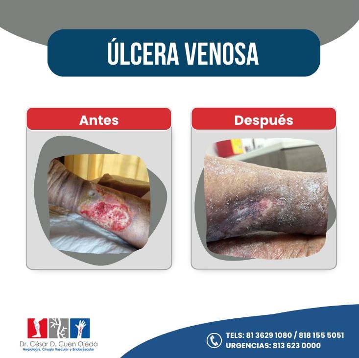 César Daniel Cuen Ojeda-14