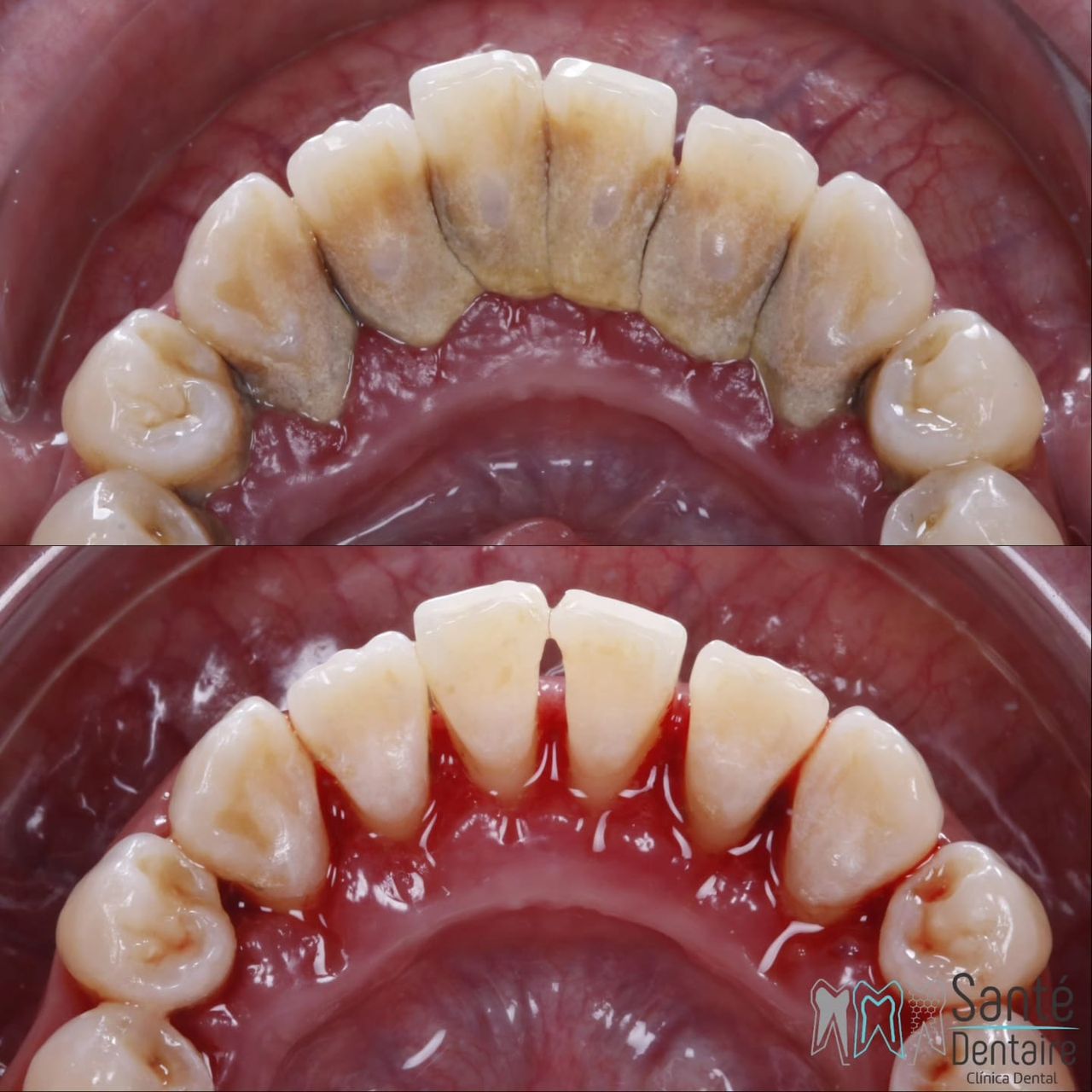 Daniel Oñate Robledo-36