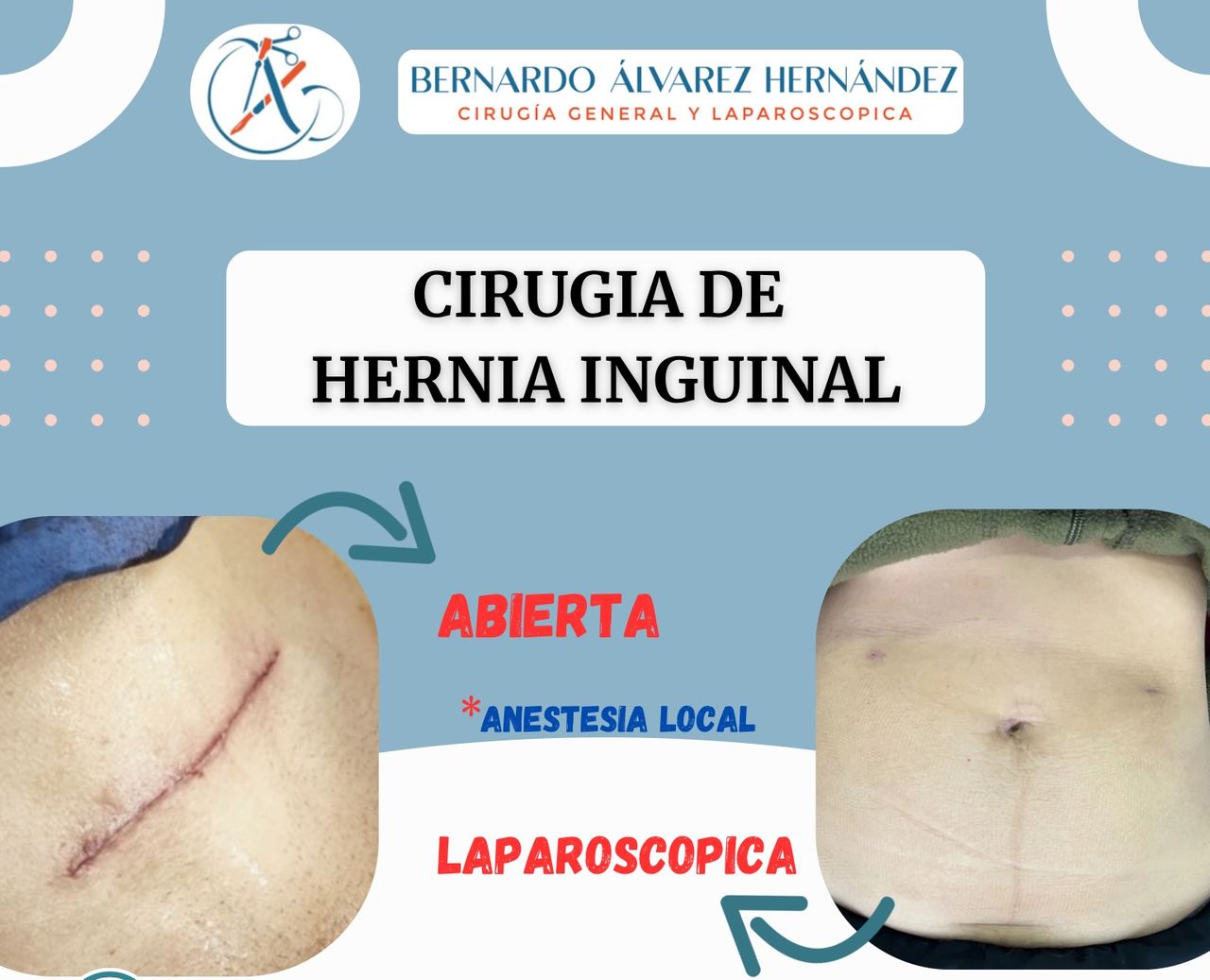 Bernardo Álvarez Hernández-6