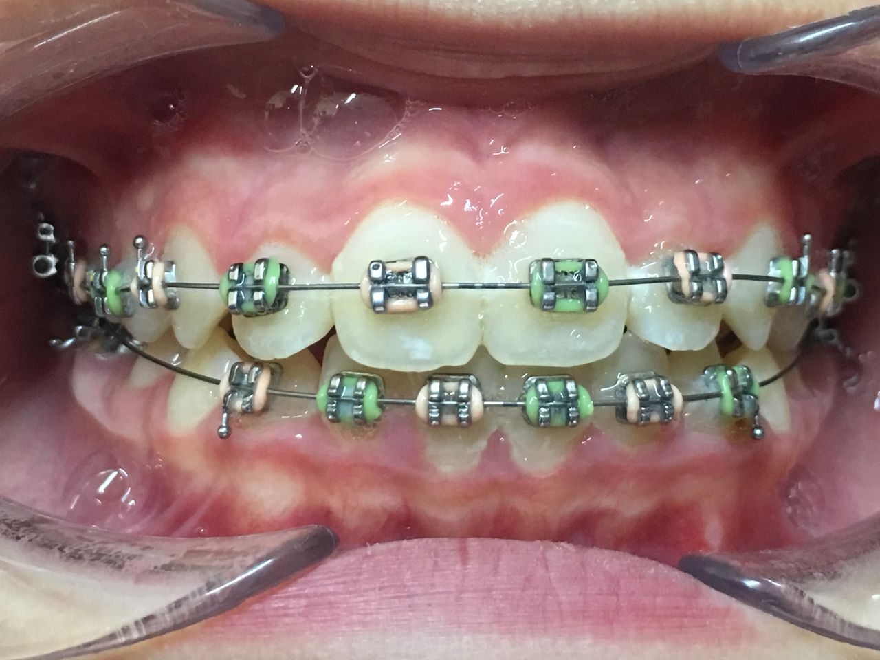 Patricia Rizo Palos-13