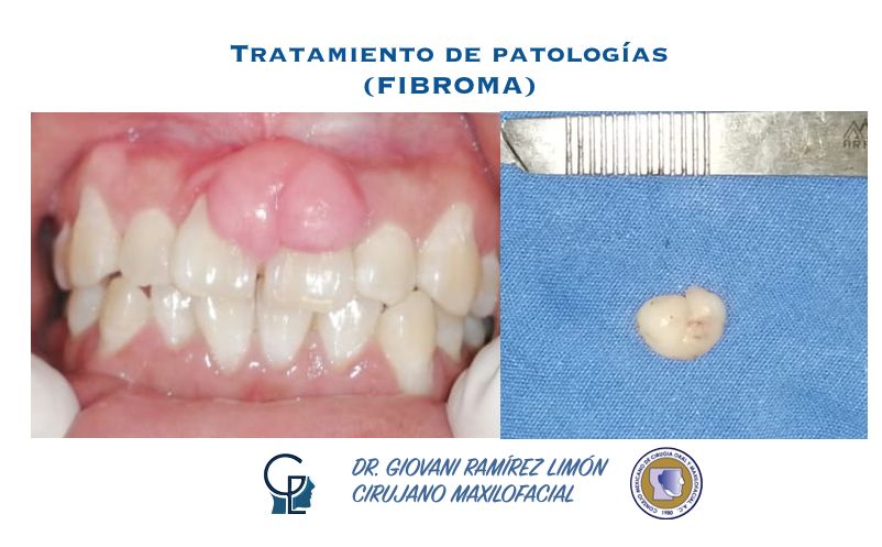 Giovani Ramírez Limón-38