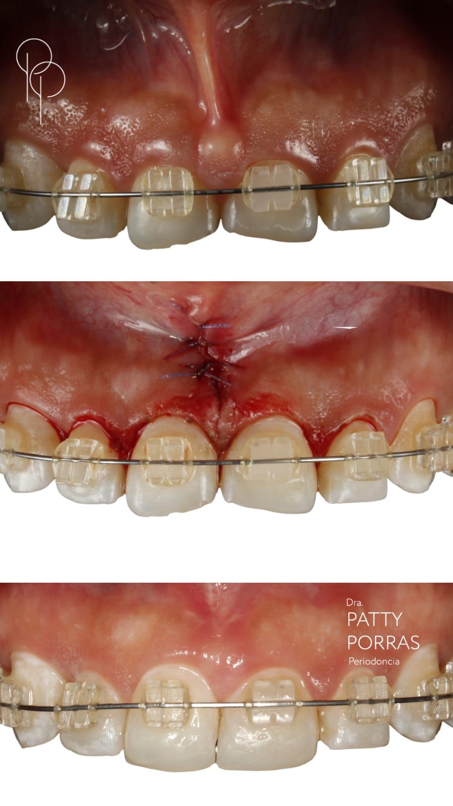 Patricia Porras Domínguez-7