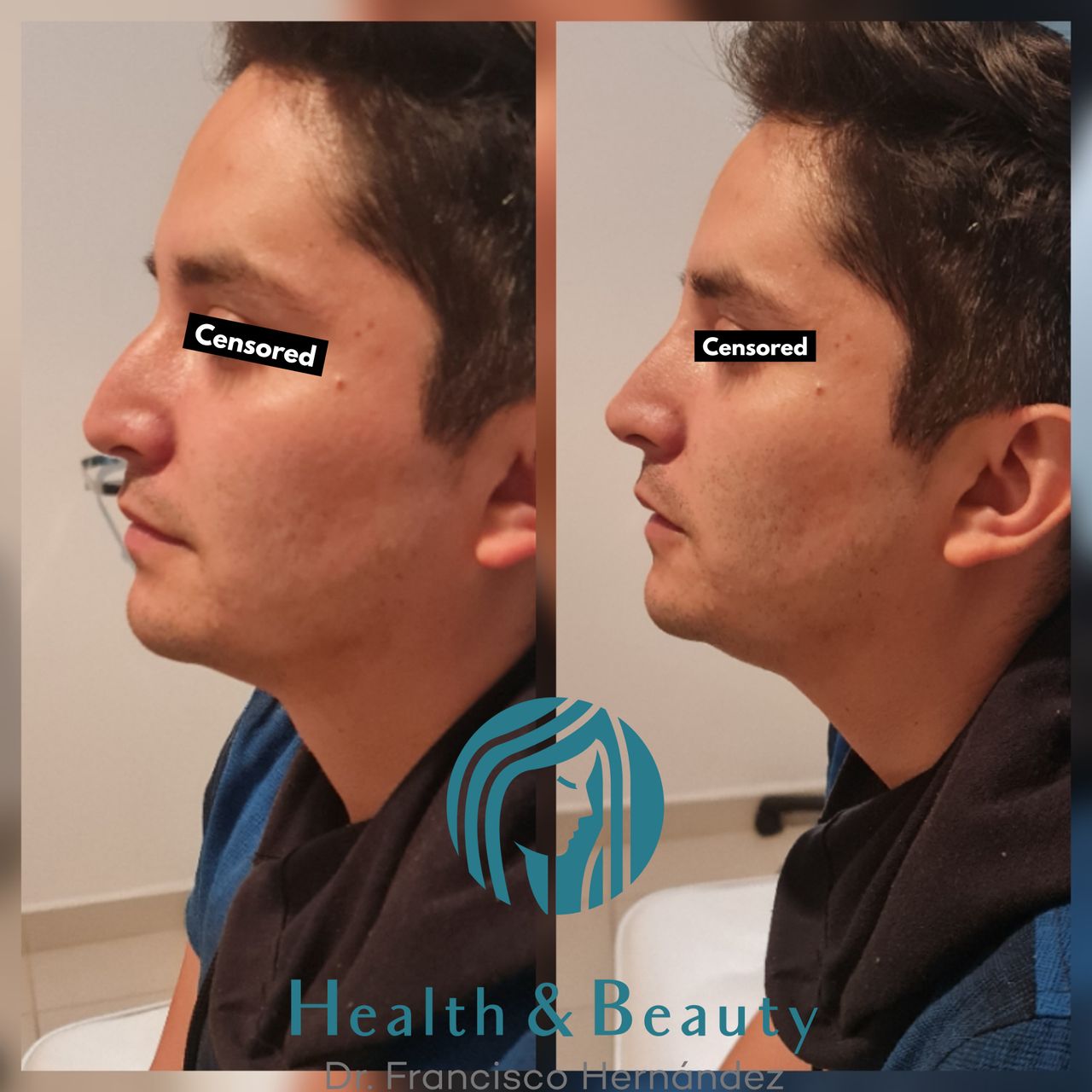 Francisco Hernández Gómez Crespo-94