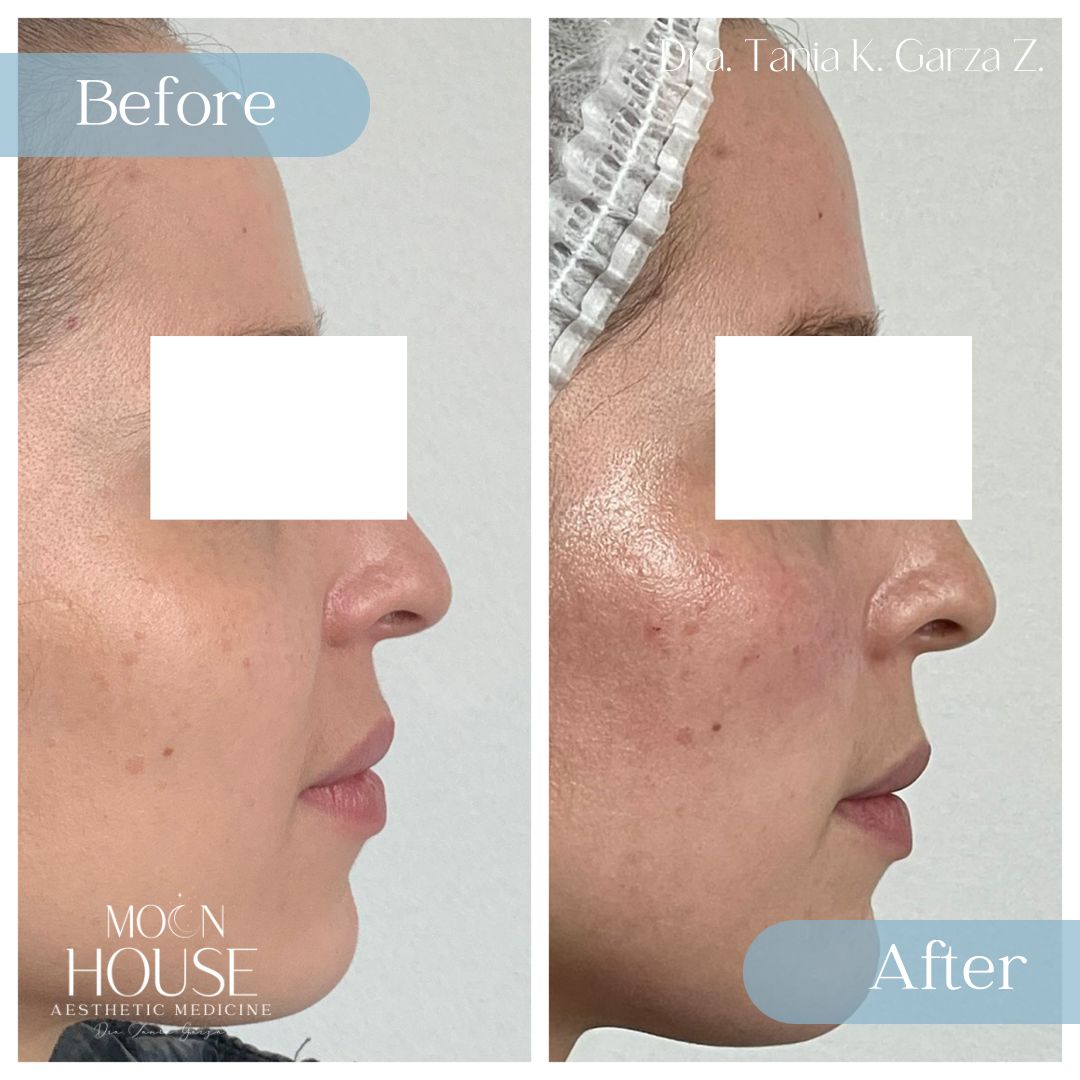 Tania Karine Garza Zepeda-15