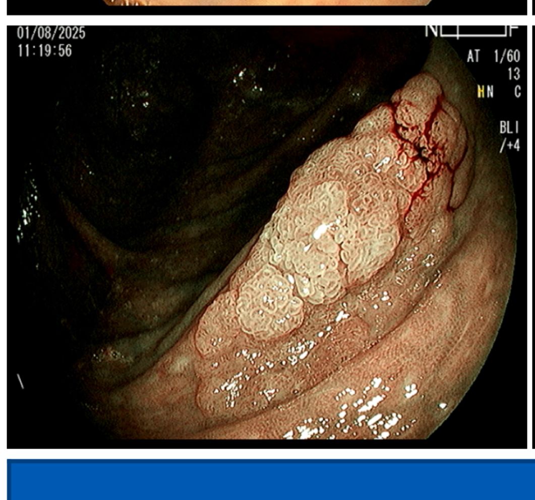 Jorge Alberto Ortega Tecuatl-3