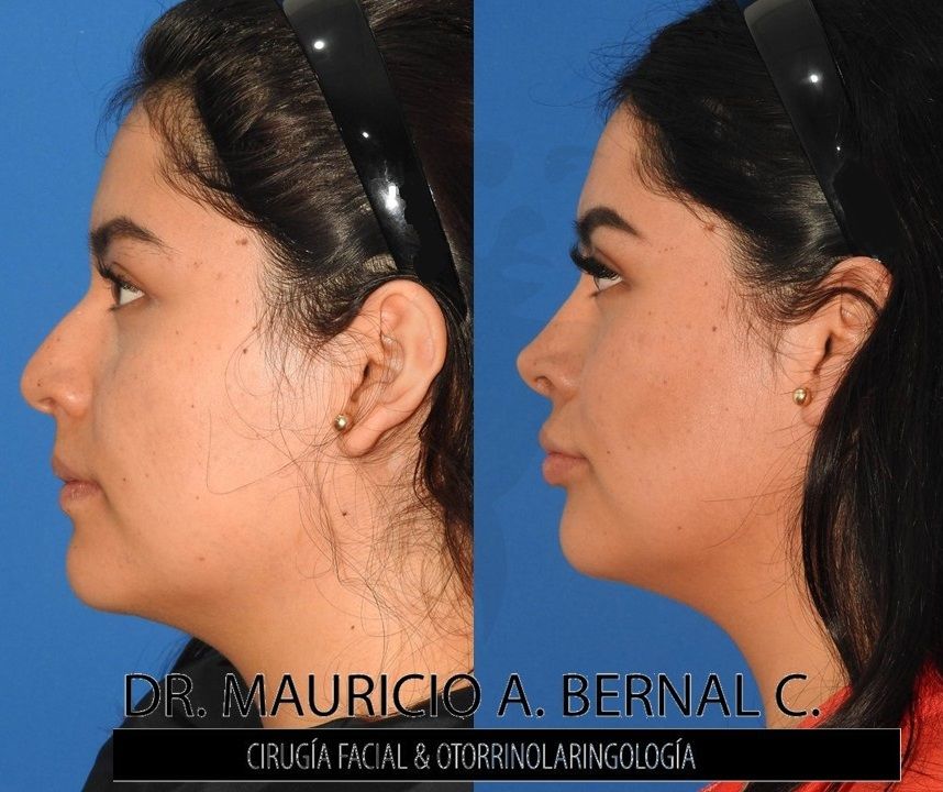 Mauricio Alejandro Bernal Carreon-16