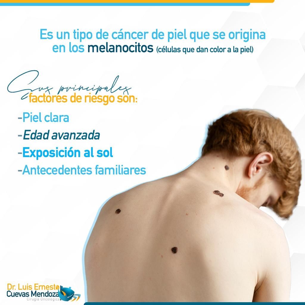 Luis Ernesto Cuevas Mendoza-114