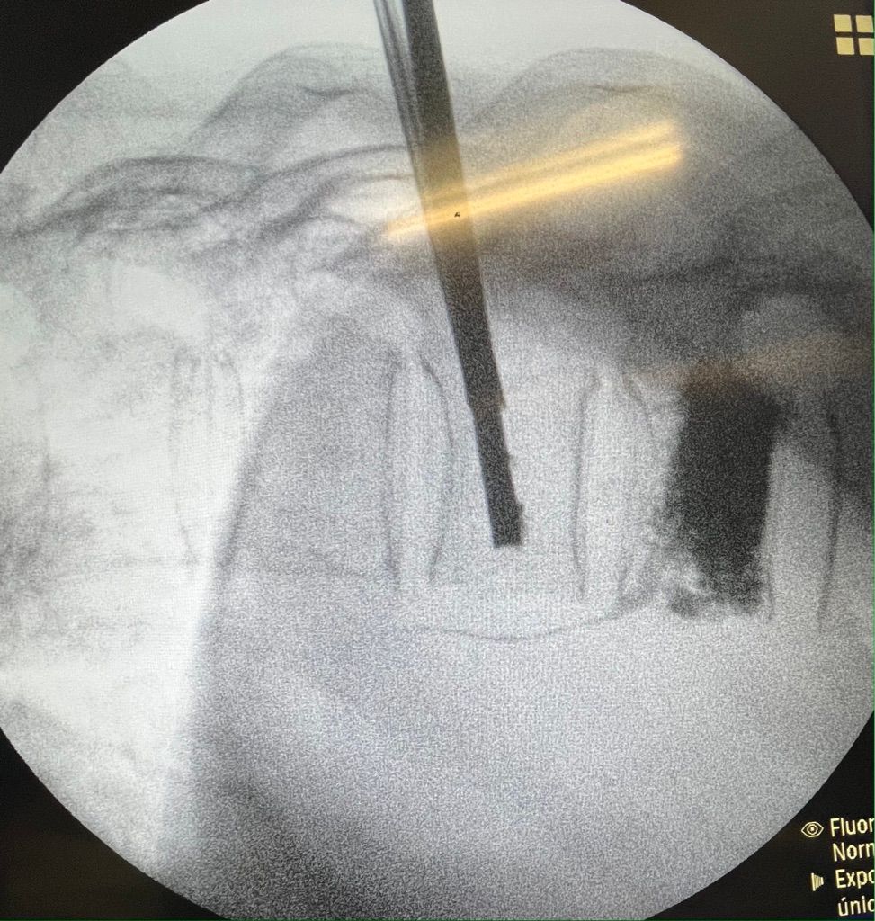 Gisela Cleto Zepeda-174