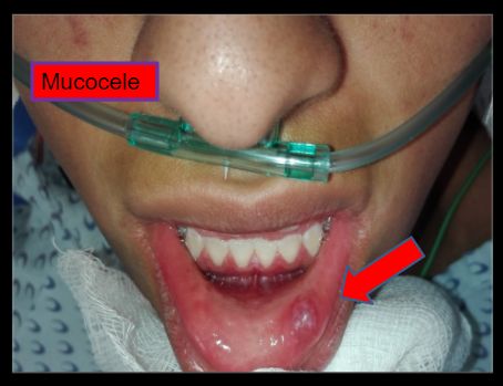 Diana Araceli Dávila Hernández-18