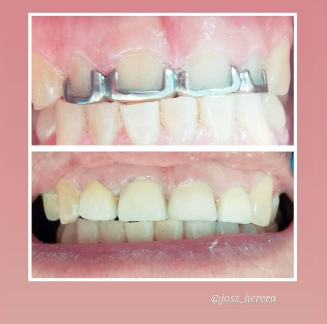 Jocelyn Herrera Santoyo-27