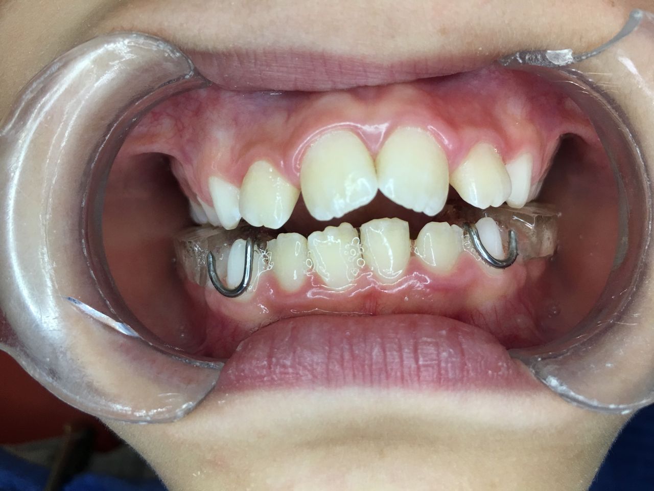 Patricia Rizo Palos-25