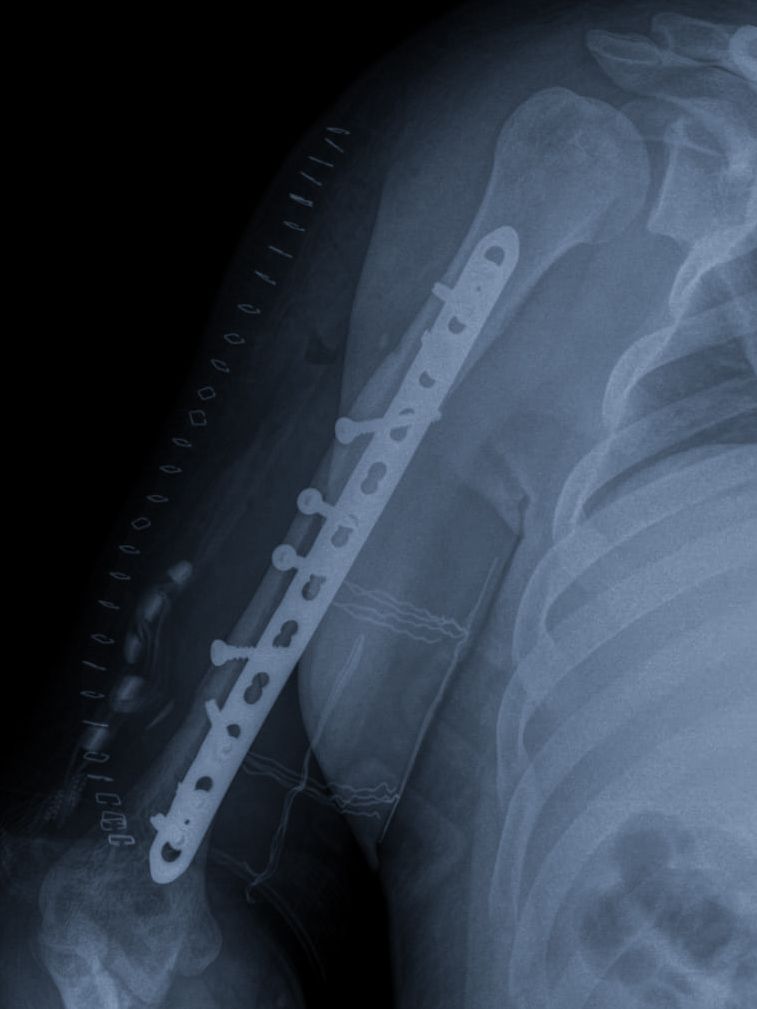 Cesar Daniel Maldonado Cortez-11