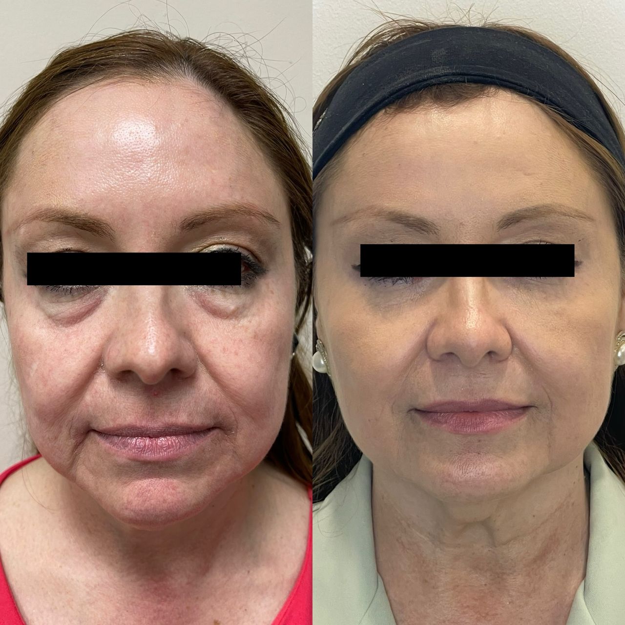 Arturo Robles Tenorio-0