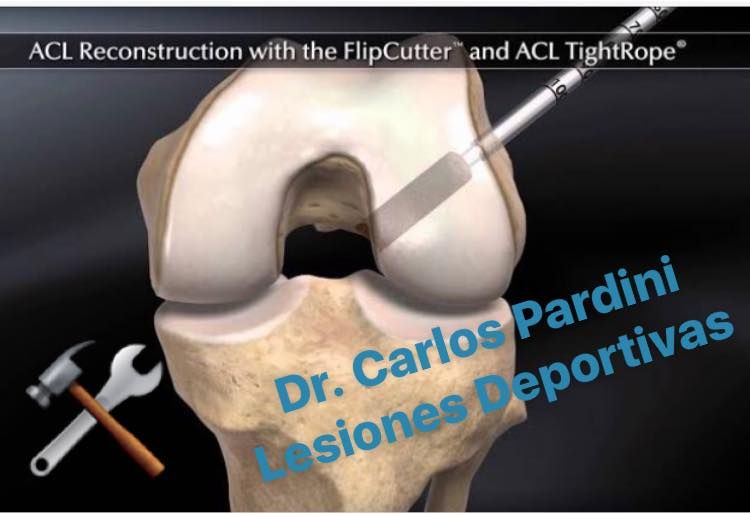 Carlos Gpe. Pardini Angulo-13