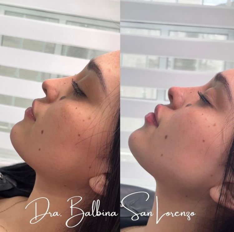 Balbina San Lorenzo Diaz-0