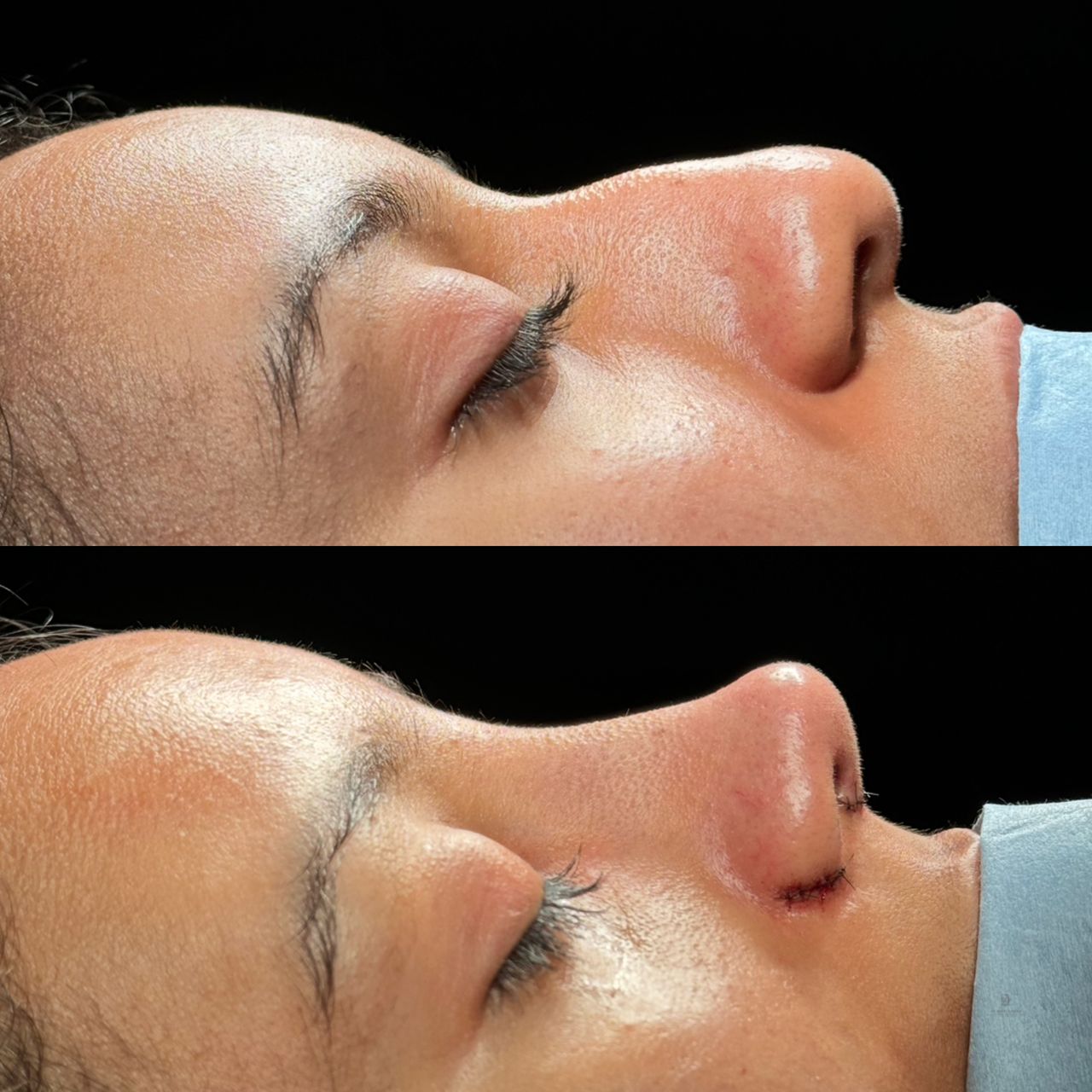 Angel Castro Urquizo-214