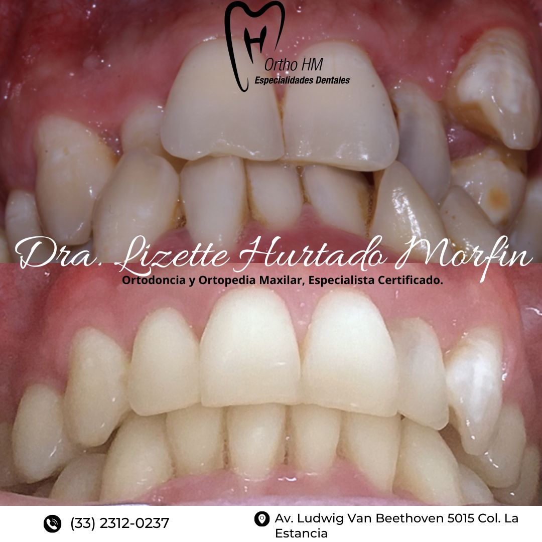 Lizette S. Hurtado Morfin-7