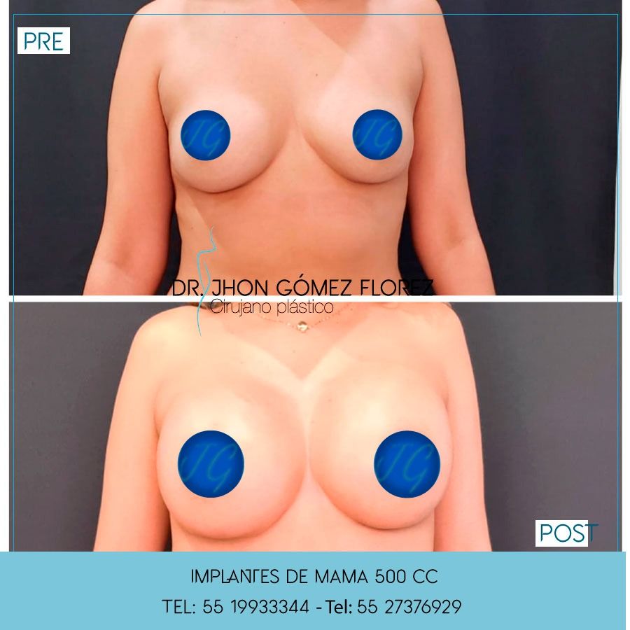 Jhon César Gómez Florez-23