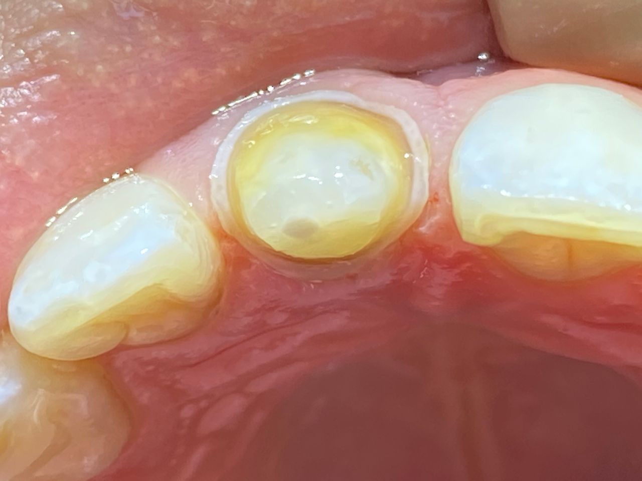 Raúl Méndez Cifuentes-4