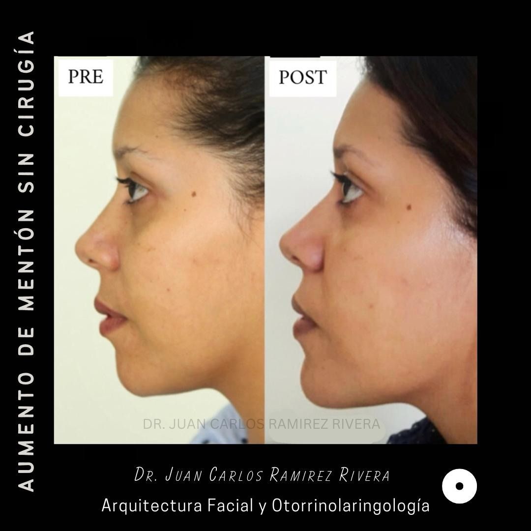 Juan Carlos Ramirez Rivera-7