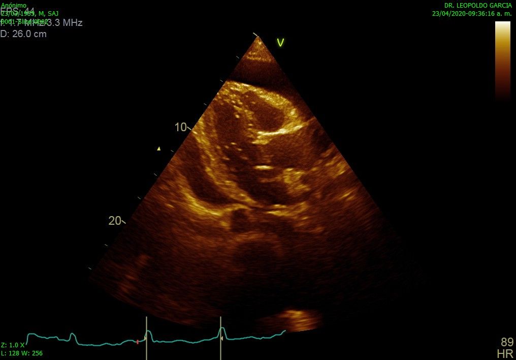 Leopoldo Garcia Lamas-2