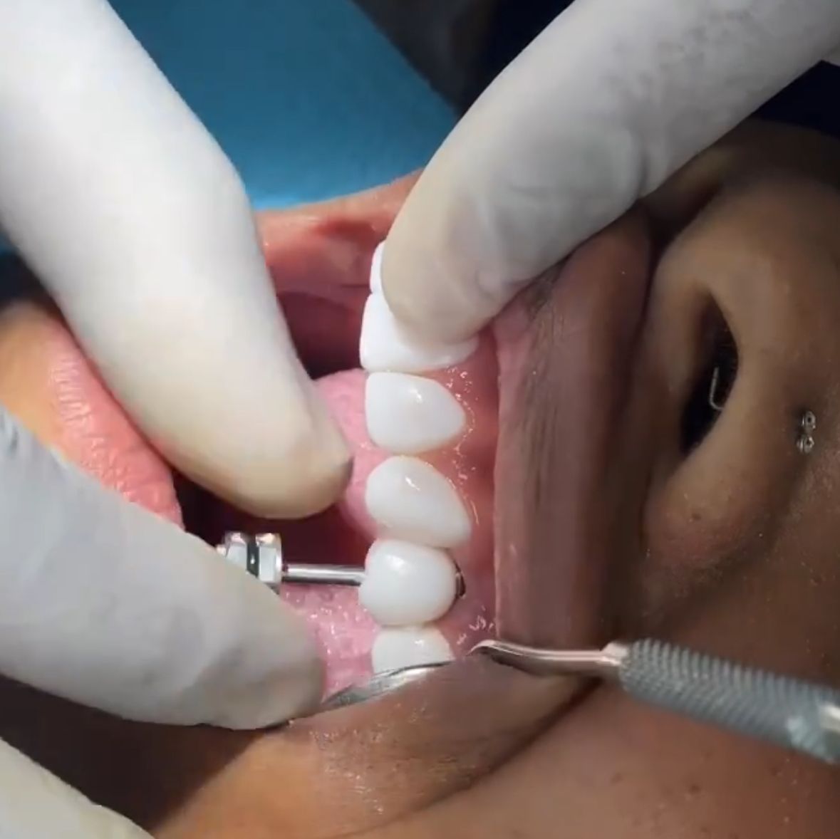 Ricardo Rosado Zamora-23