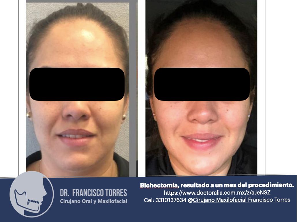 Francisco Torres-100