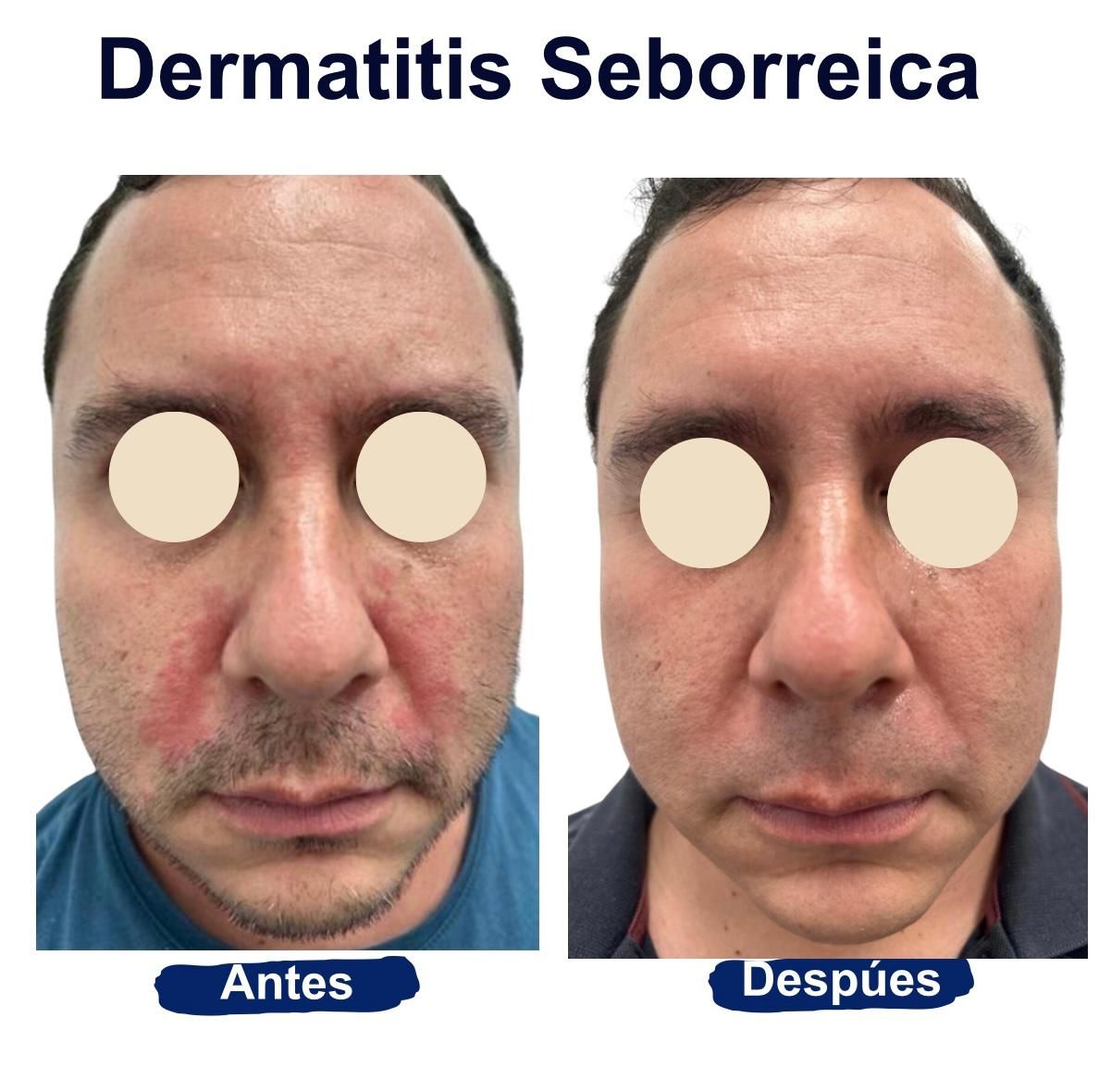 Itzel Anayn Flores Reyes-49