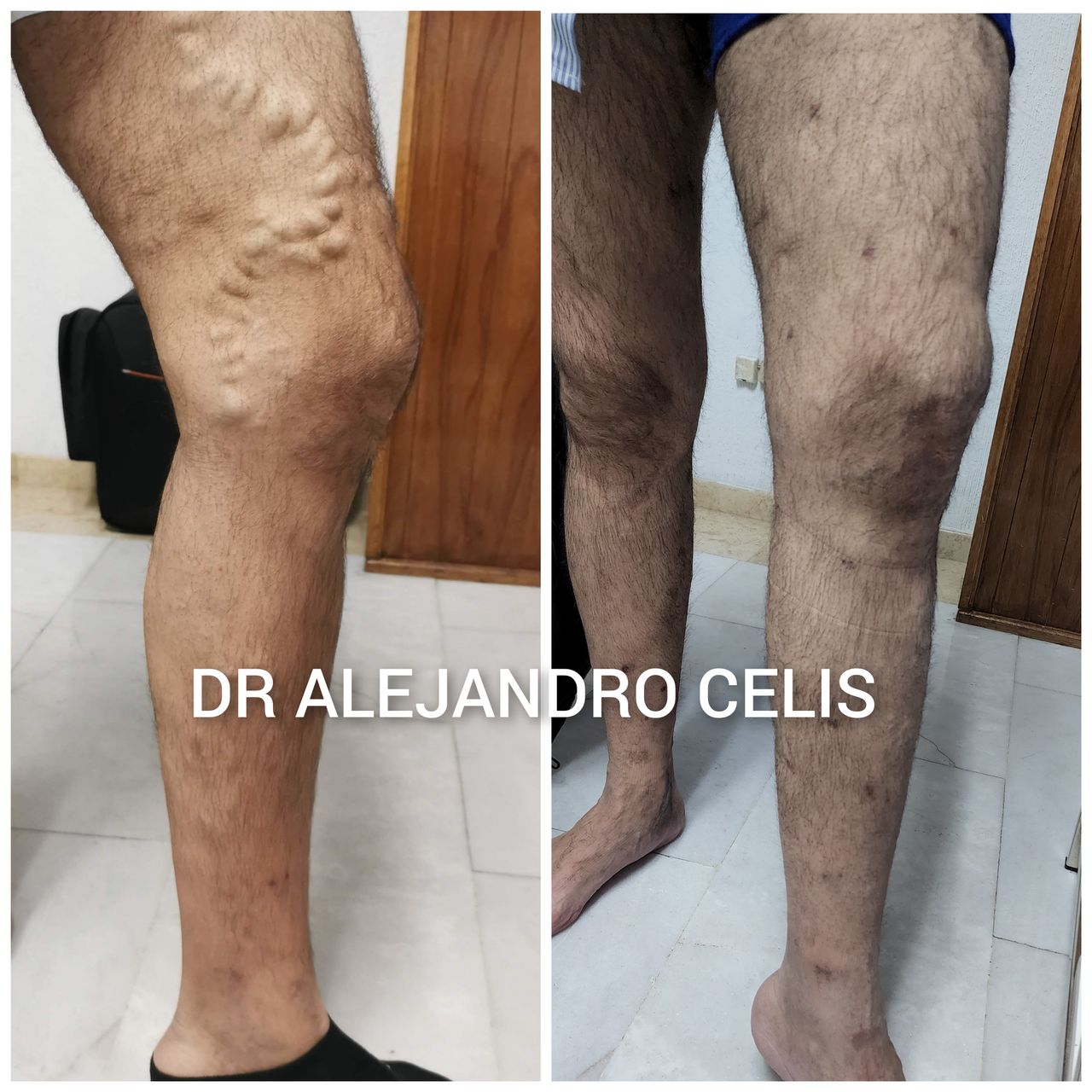 Alejandro Celis Jiménez-7