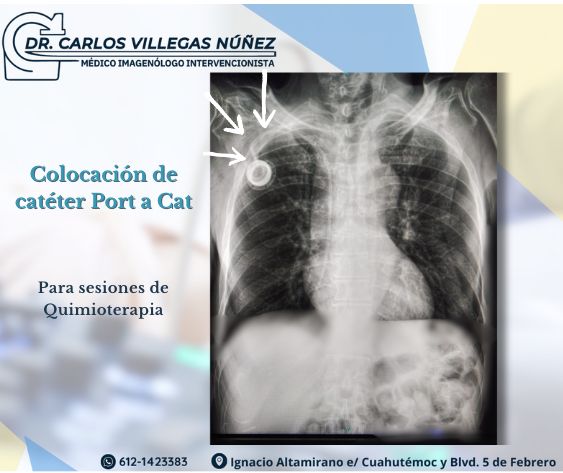 Carlos Enrique Villegas Nuñez-1