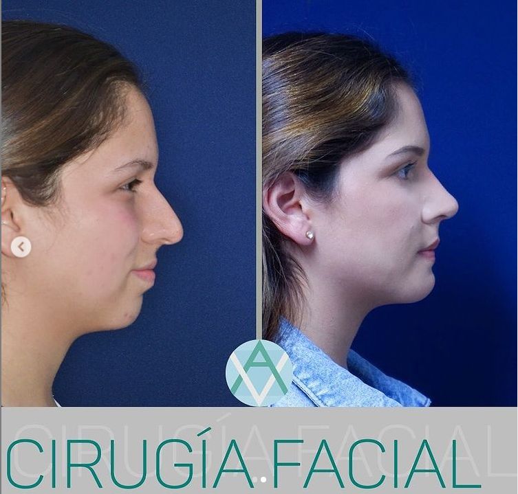 Alfonso Villaseñor Herrero-7