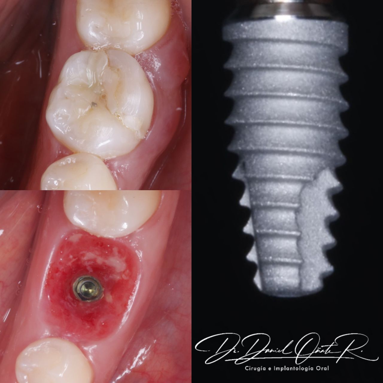 Daniel Oñate Robledo-3