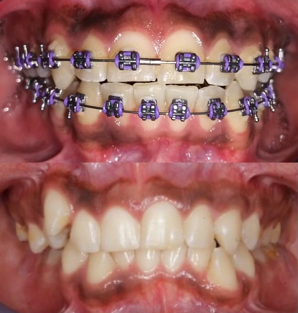 Luz Anel Valente Lozano-1