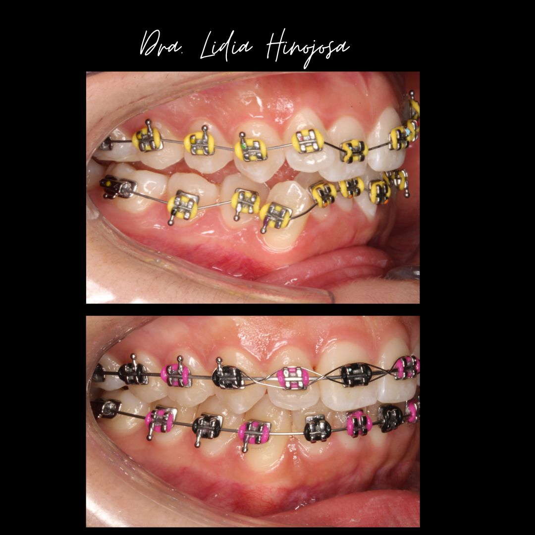 Lidia Abigail Hinojosa Arellanes-36