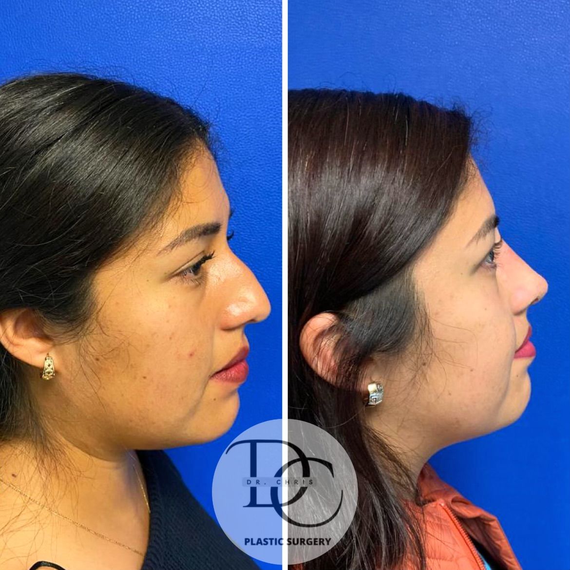 Christian Porras Mendez-3