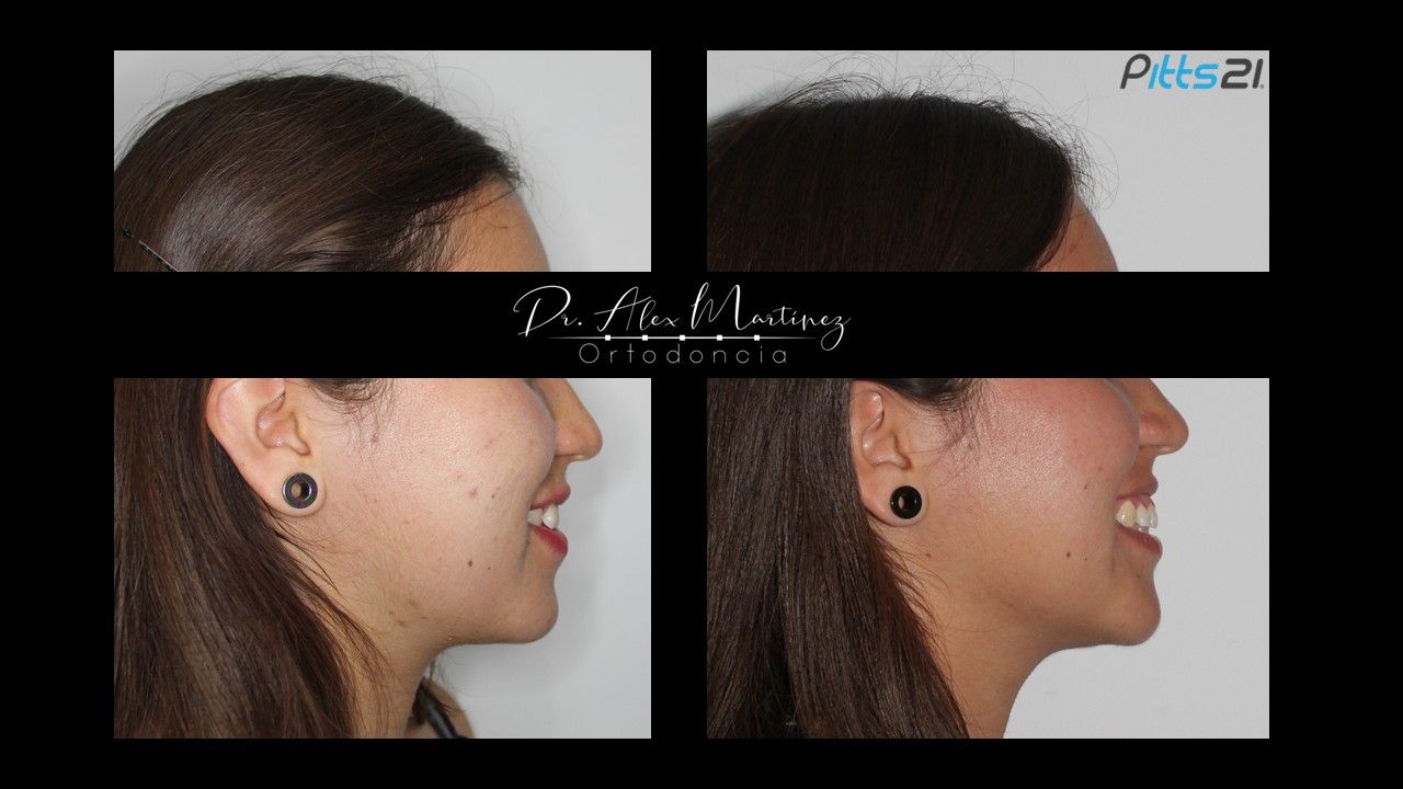 Alejandro Martínez Hernández-24