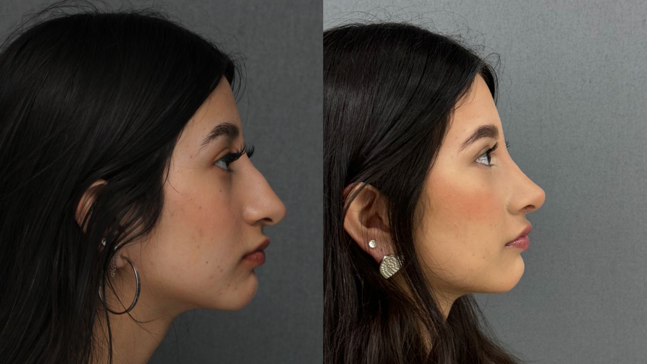 Angel Castro Urquizo-72