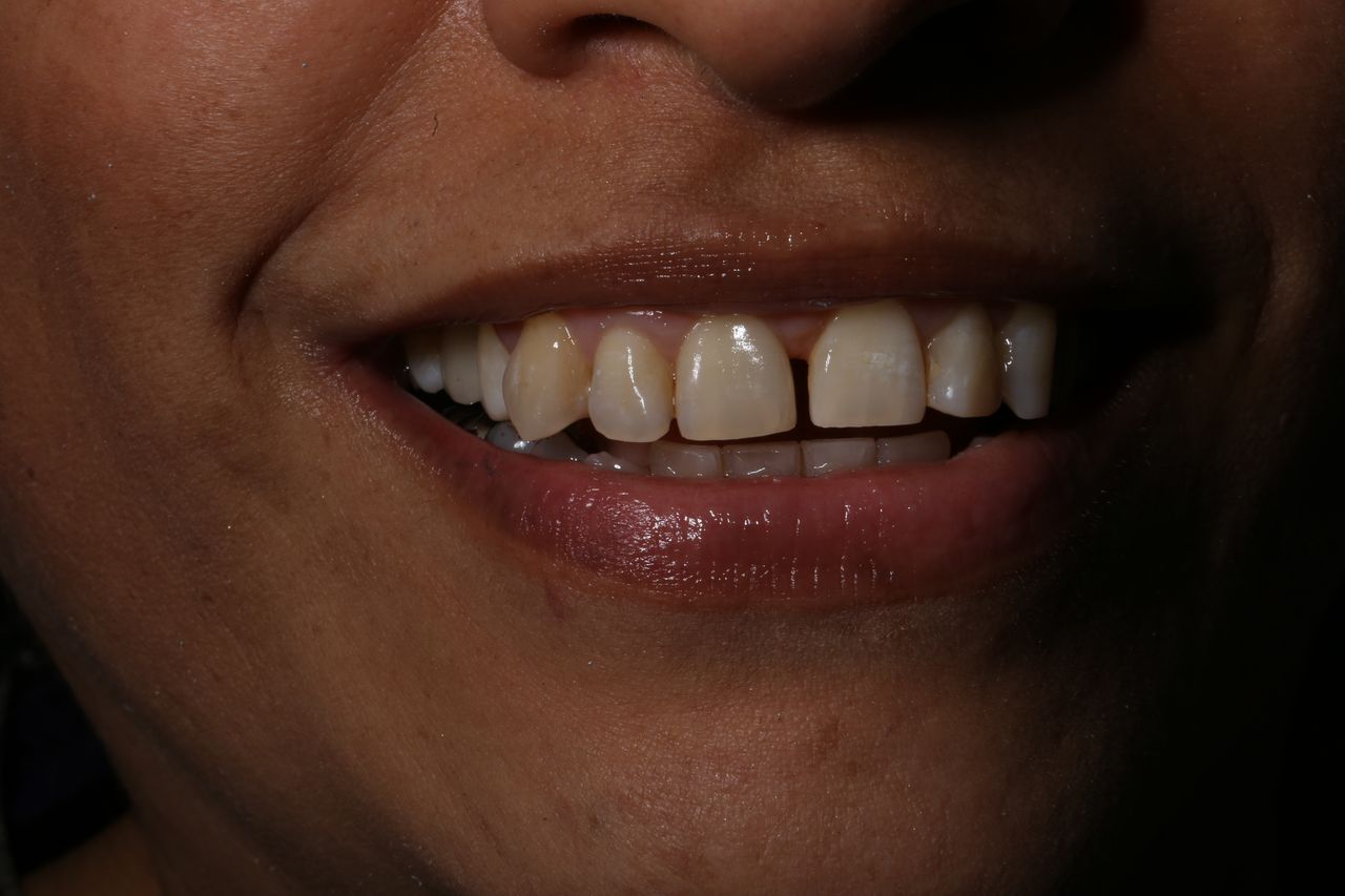 Oscar Alejandro Azcárate Tendilla-5