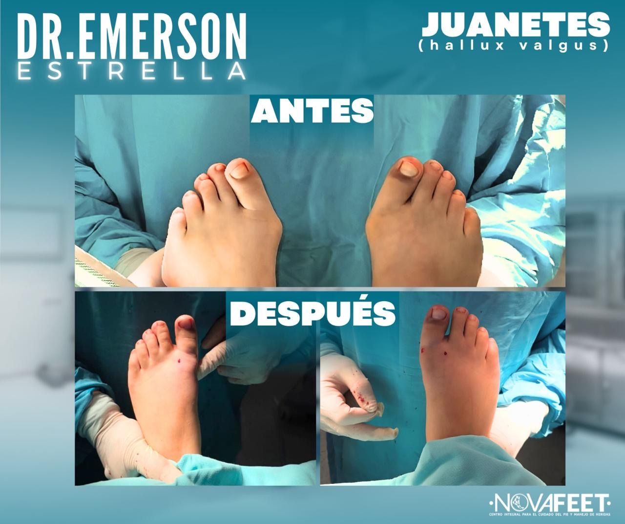 Emerson Estrella-1