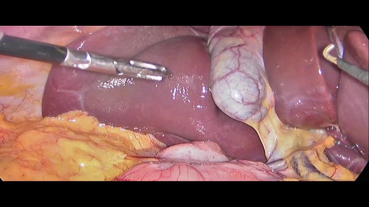 Diego A. Martinez Reyes-3