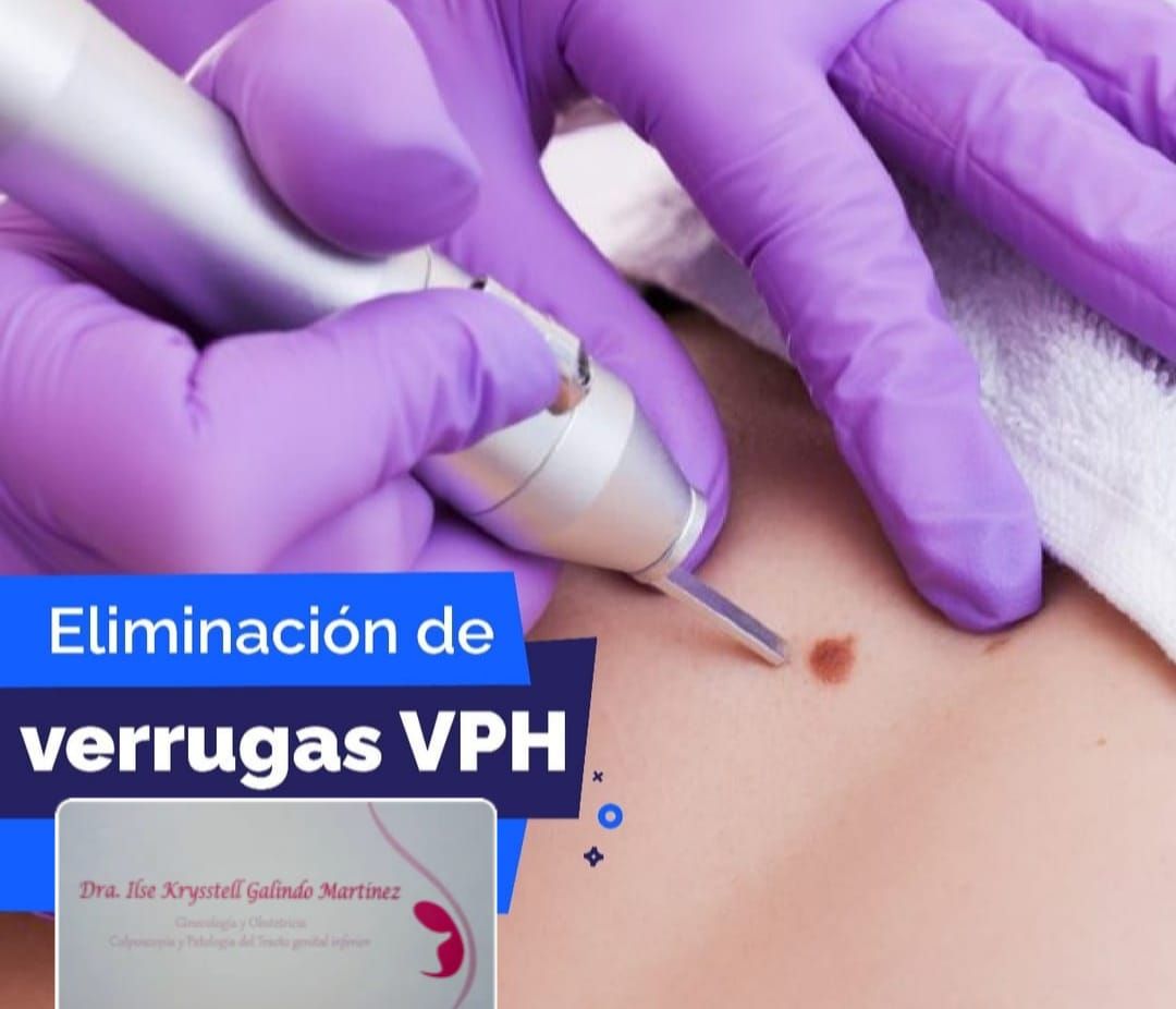 Ilse Krysstell  Galindo Martinez -8