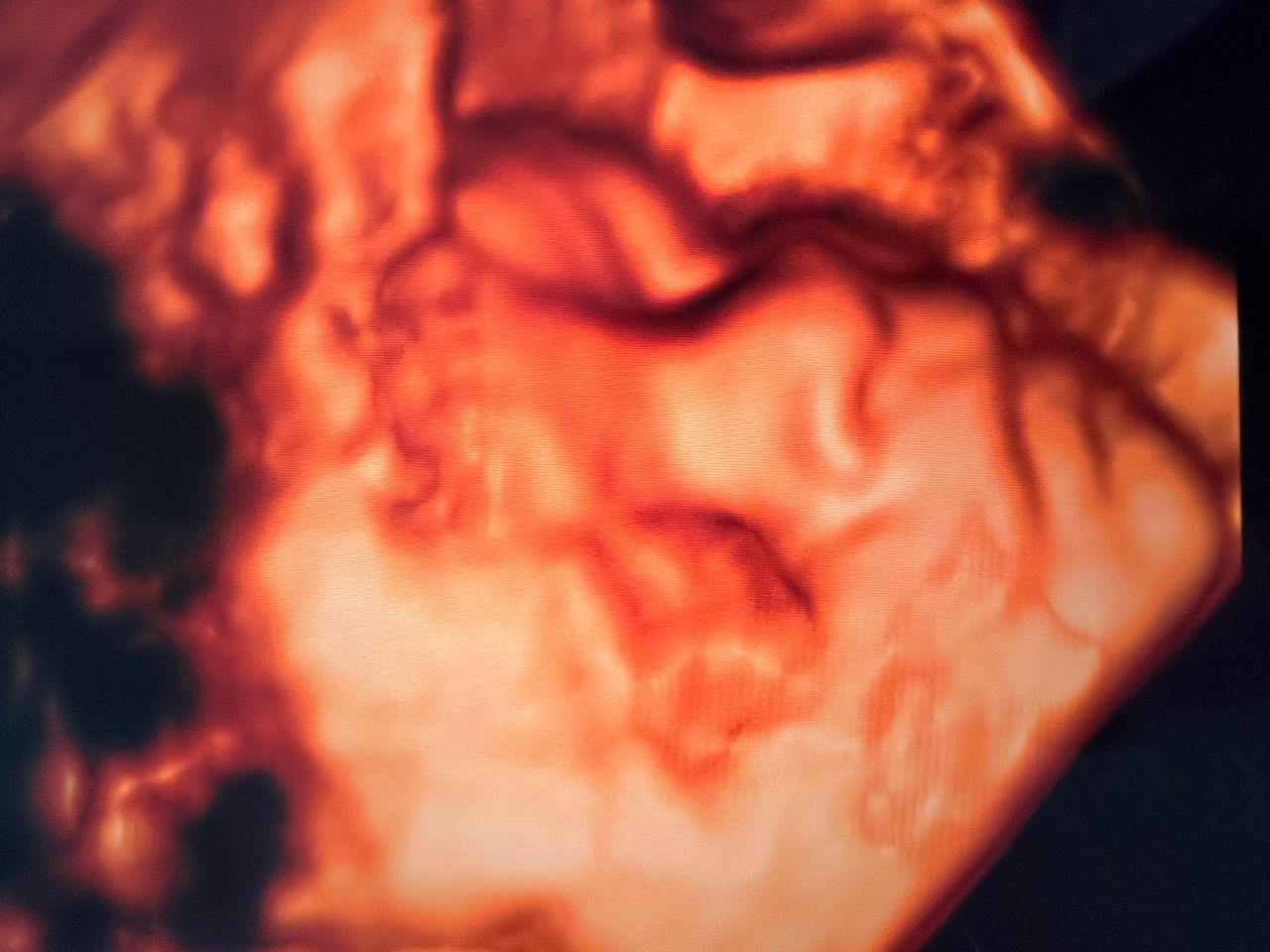 Benjamín Isai Molina Solís-6