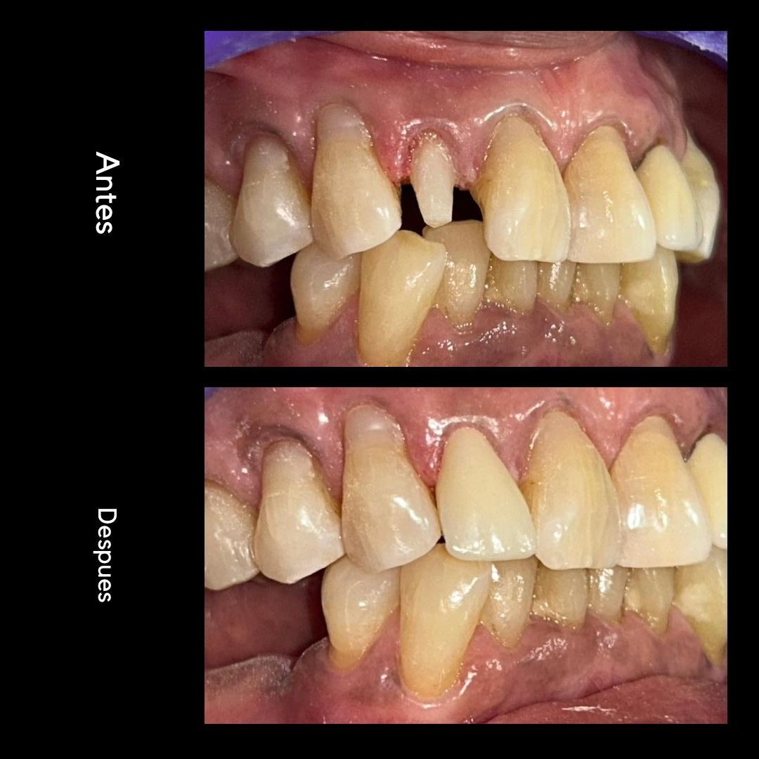 Aaron Cruz Gutiérrez-2