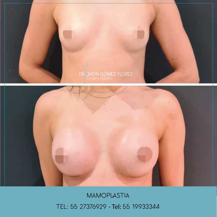 Jhon César Gómez Florez-3