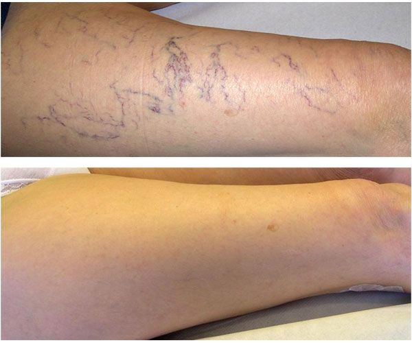 Erika Berenice Ramírez Pérez-9