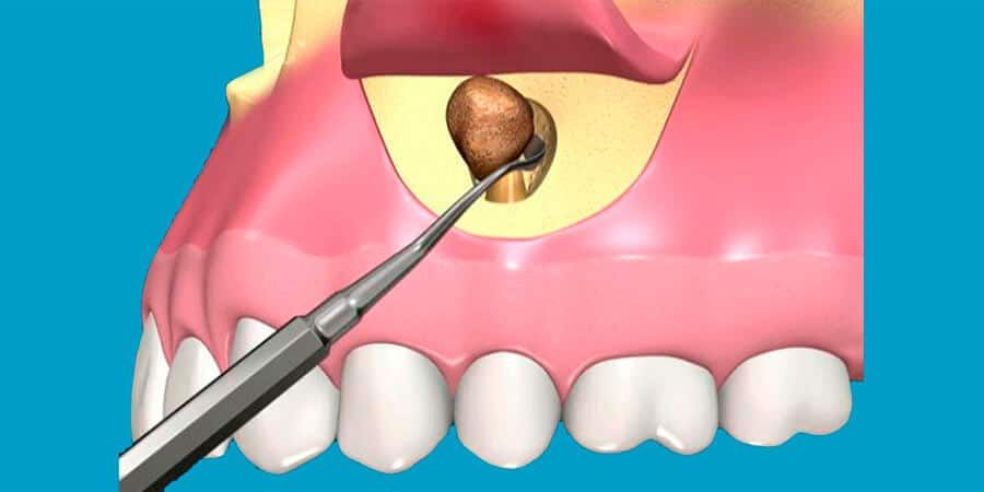 Alberto Rivera Nava-9