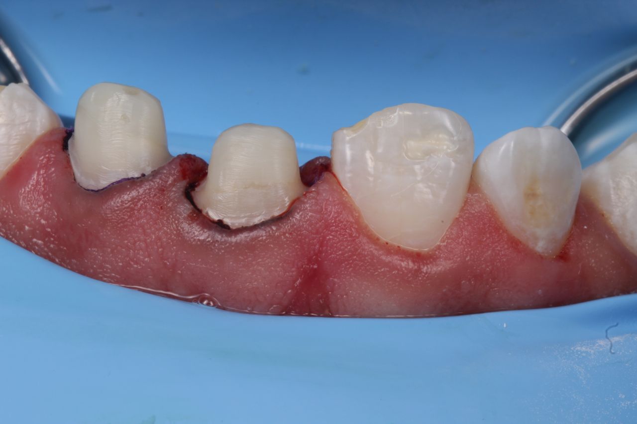 Fernando Fuentes Lozada-8