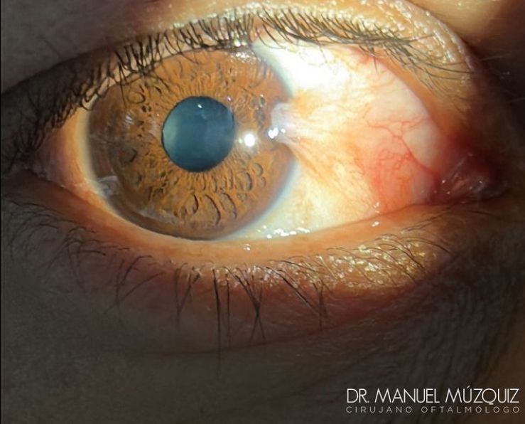 Manuel Alejandro Muzquiz Jimenez-6