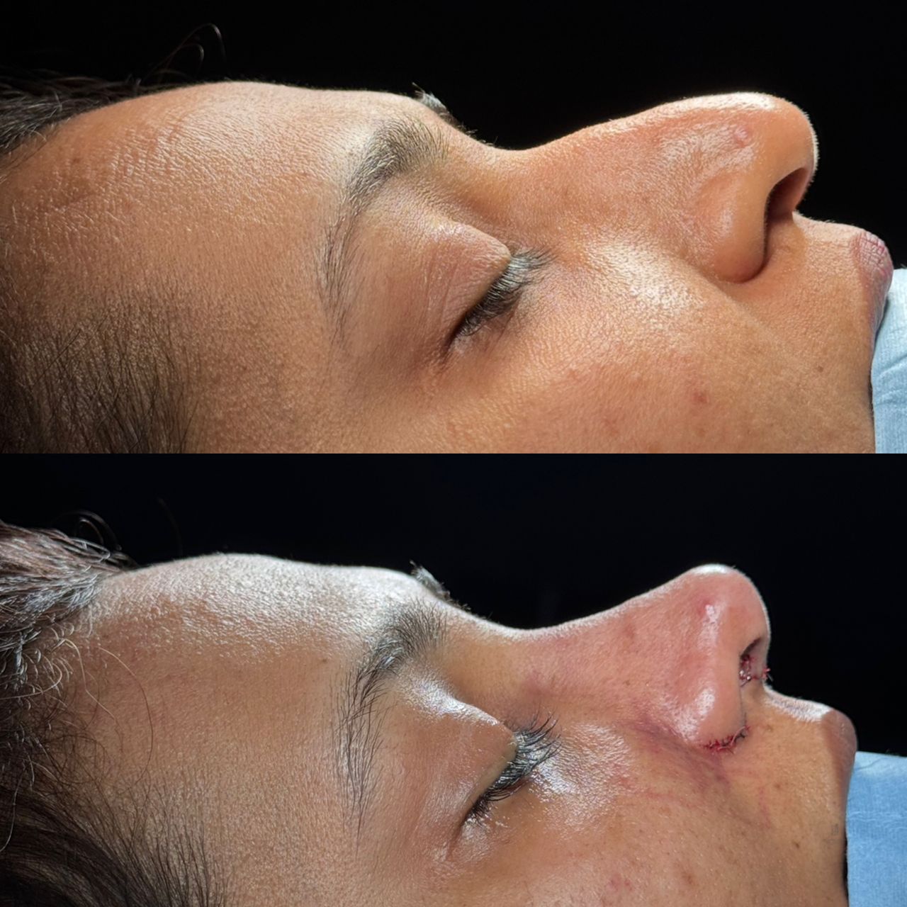 Angel Castro Urquizo-216