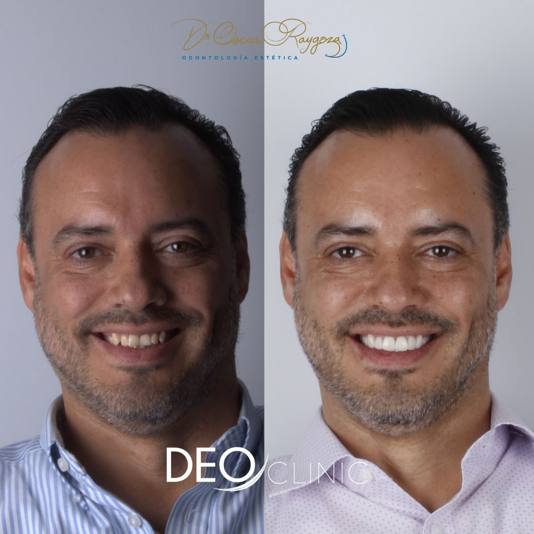 Oscar Raygoza Carrillo-15